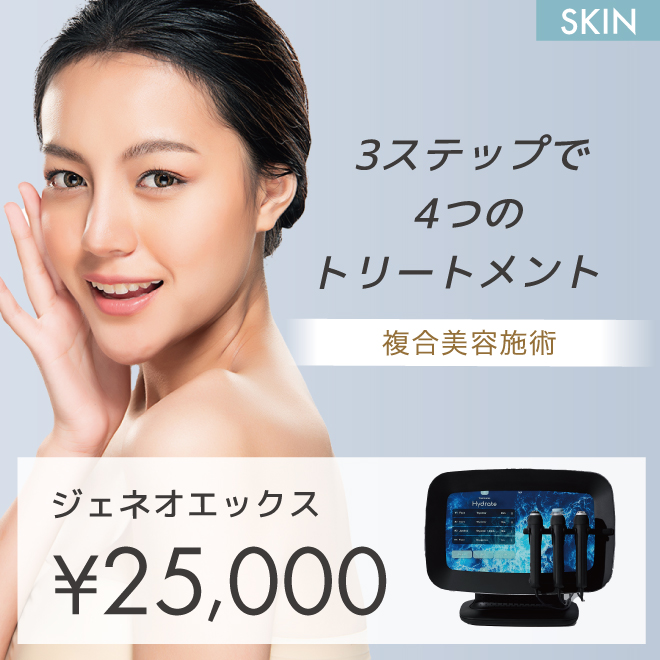 ジェネオエックス