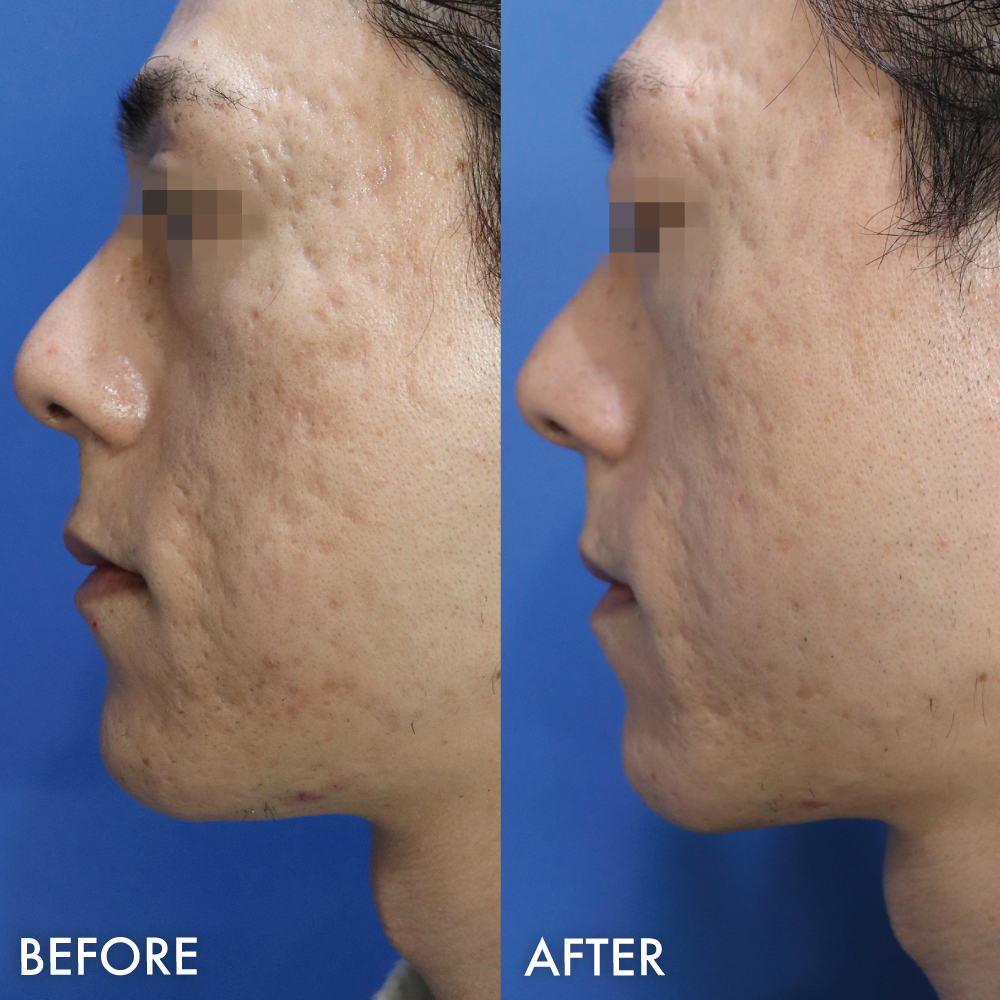 ジュベルック症例